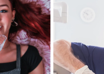 Diamond Smile Teeth: De Sleutel tot Een Stralende Lach