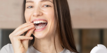 Smile White: A Comprehensive Overview of Their Offerings and Unique Approach