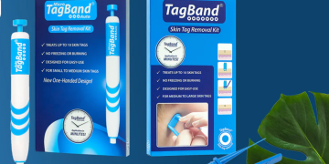 TagBand UK: A Closer Look at Their Skin Tag Removal Solutions